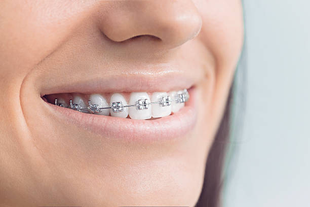 Best Wisdom Tooth Removal  in Zephyrhills West, FL